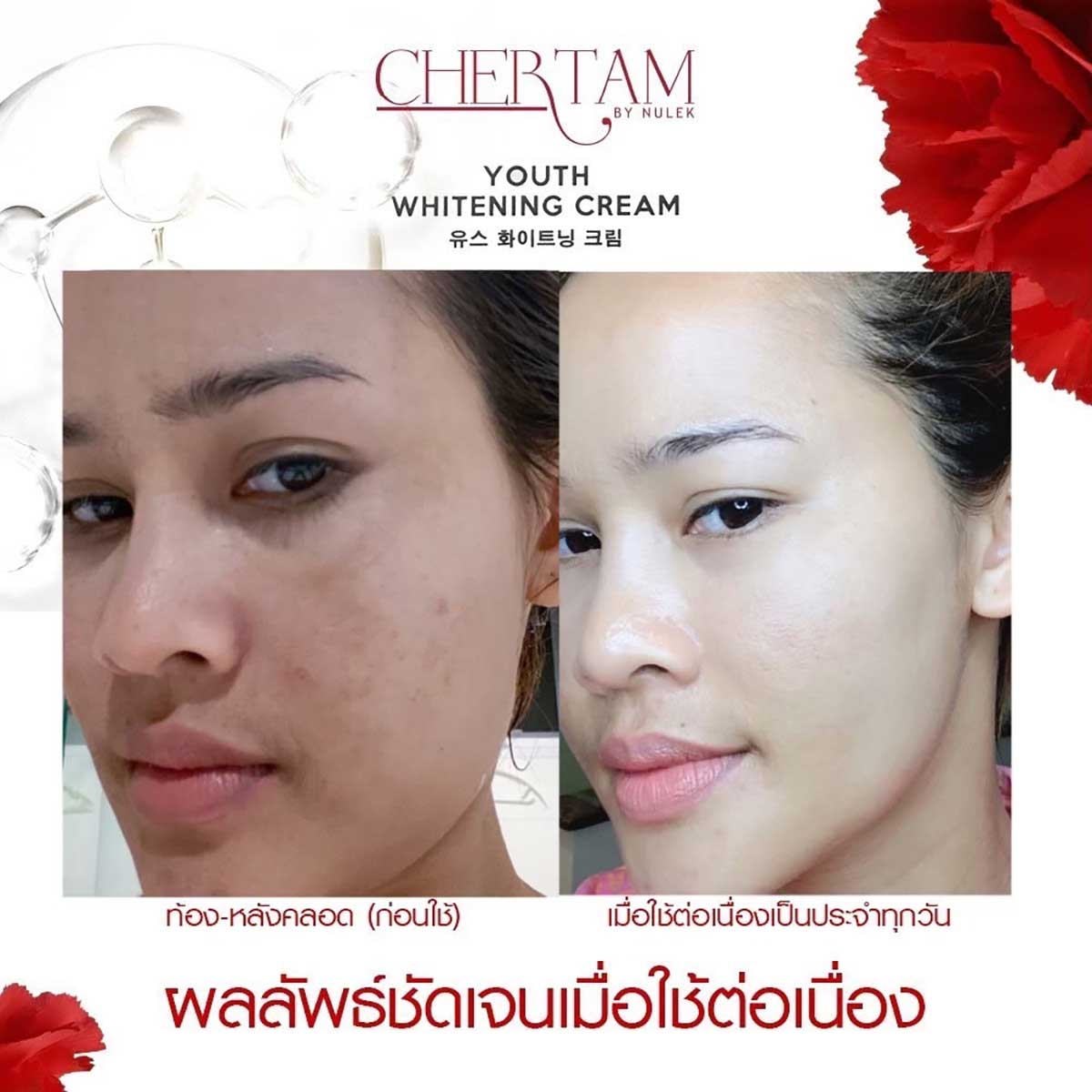 2 Boxes Chertam By Nulek Youth Whitening Cream 30g/Box Korea Brightening Radiant Glow Skin